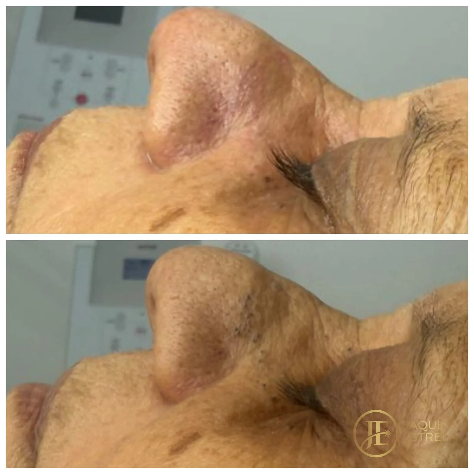 Detalhe da textura da pele antes e depois do cuidado