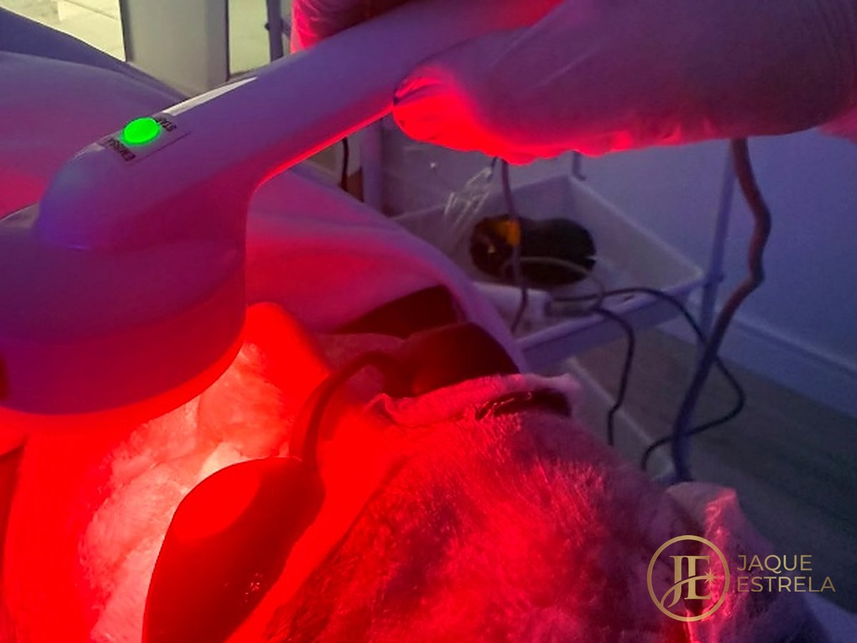 LED vermelho aplicado no couro cabeludo — atendimento no estúdio
