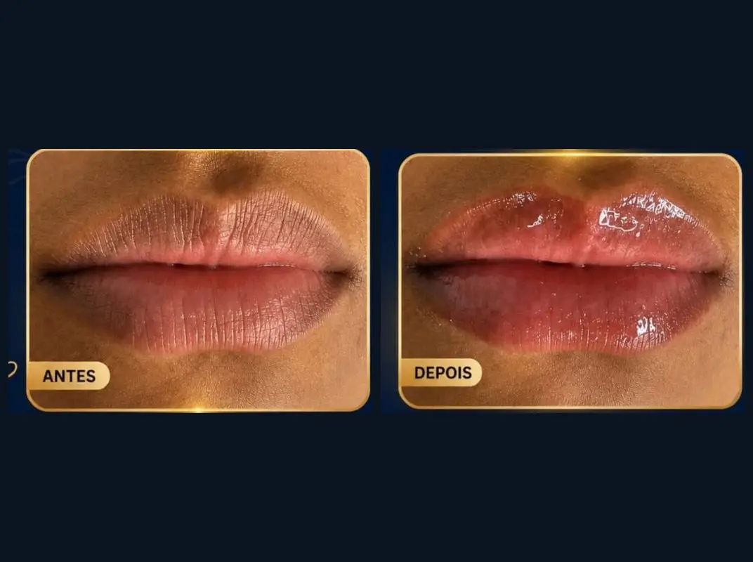 Lábios antes e depois do cuidado Lábios Irresistíveis