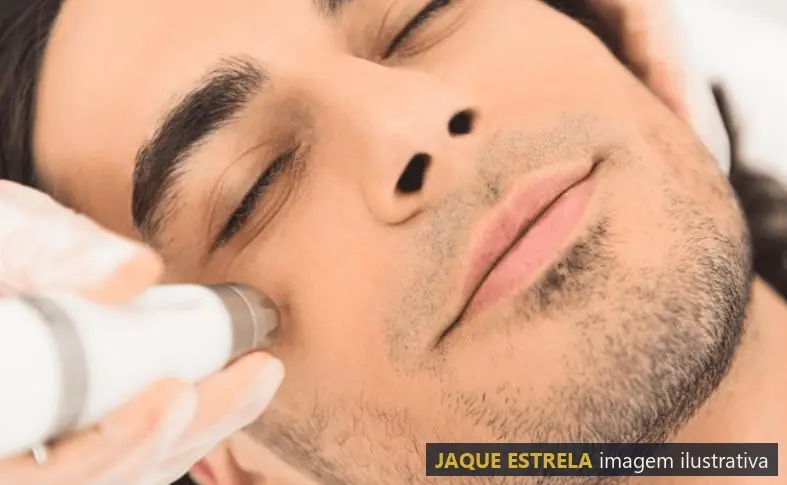 Alta frequência no rosto — imagem ilustrativa