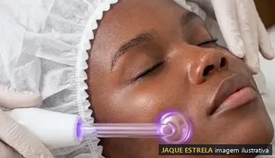 Alta frequência na pele negra — imagem ilustrativa