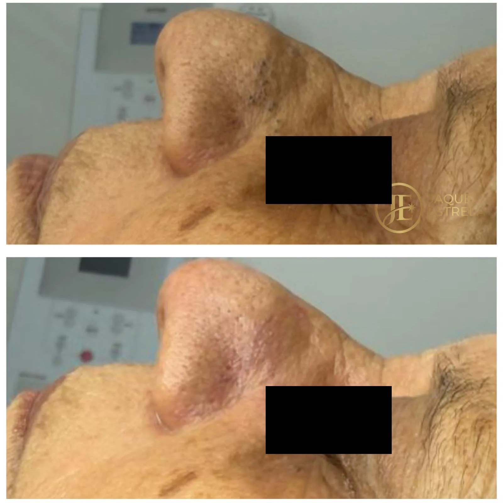 Detalhe da textura da pele antes e depois do cuidado